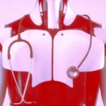 Robot torso with a stethoscope against a pink background, symbolizing the integration of AI in healthcare.