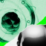 Collage of a human head silhouette, abstract green atomic structure, and torn paper edges with bright green background
